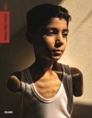 World Press Photo 2025.